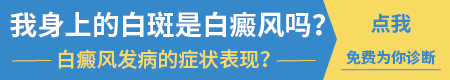 症状危害-面部白斑初期有哪些症状